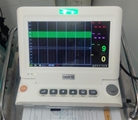 اختصاص یک عدد دستگاه فتال مانیتورینگ به زایشگاه بیمارستان خرامه به دستور رئیس دانشگاه علوم پزشکی شیرازدر بازدید از بیمارستان